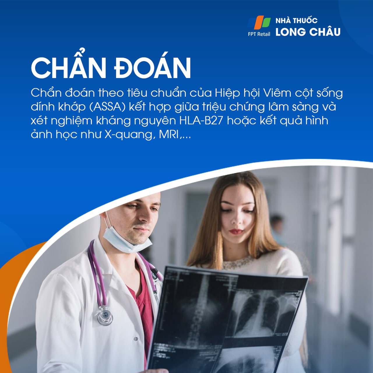 Viêm cột sống dính khớp 5