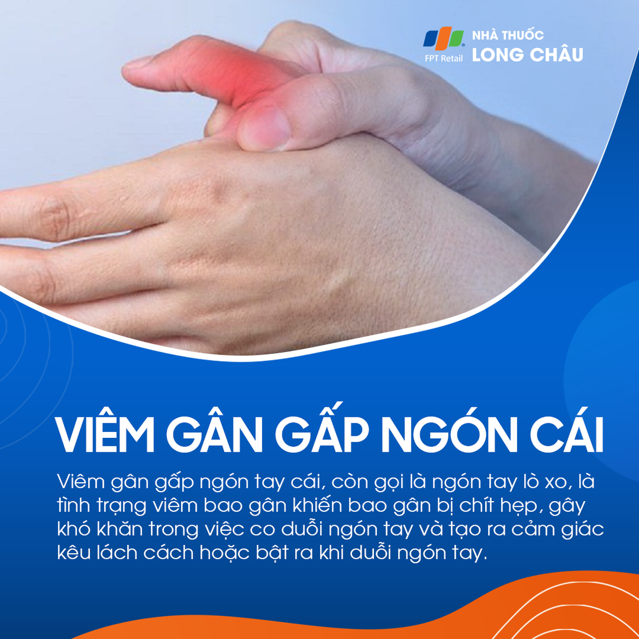 Viêm gân gấp ngón cái 1