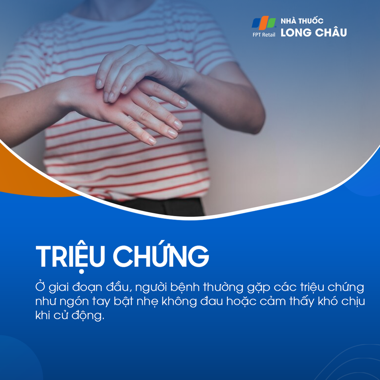 Viêm gân gấp ngón cái 3