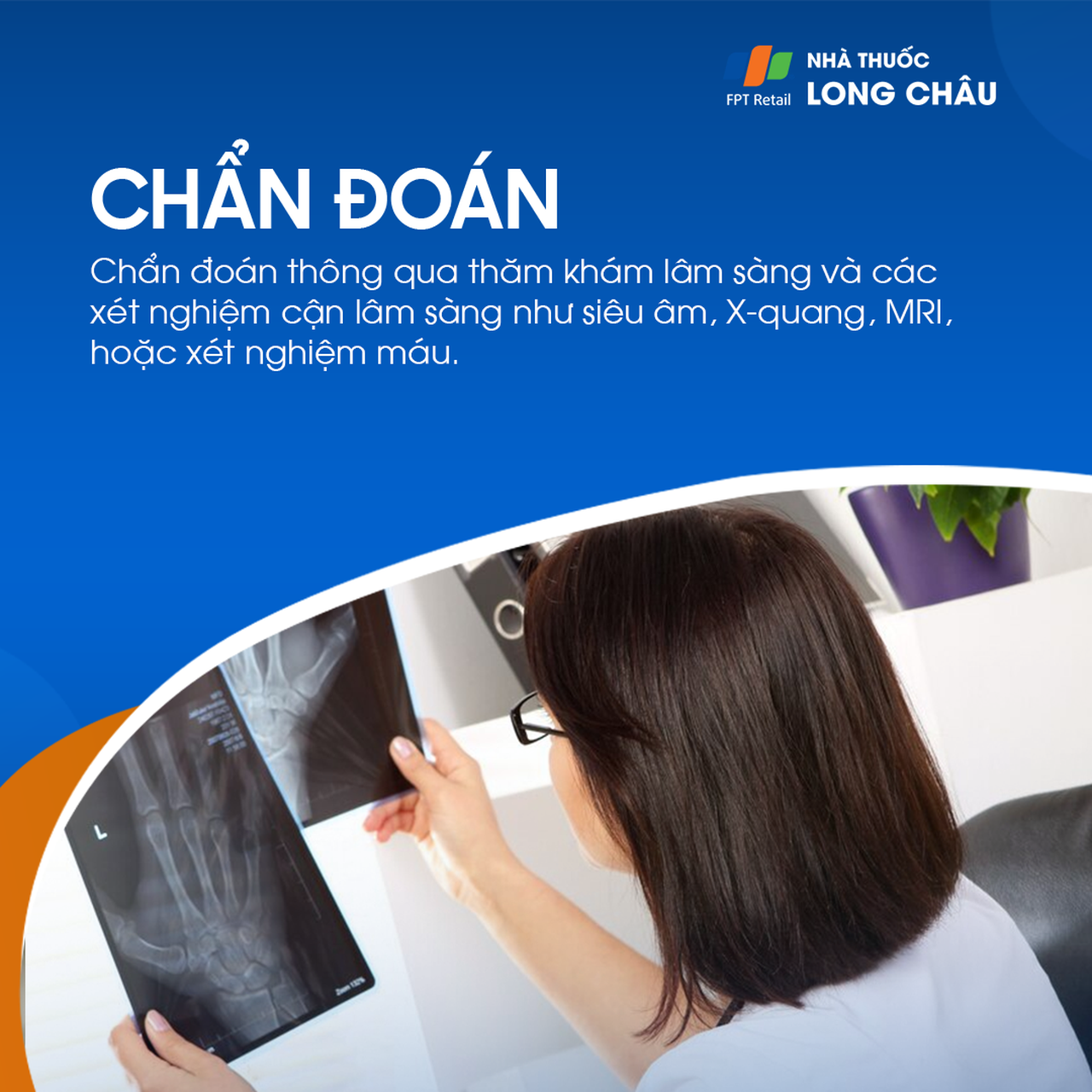 Viêm gân gấp ngón cái 6