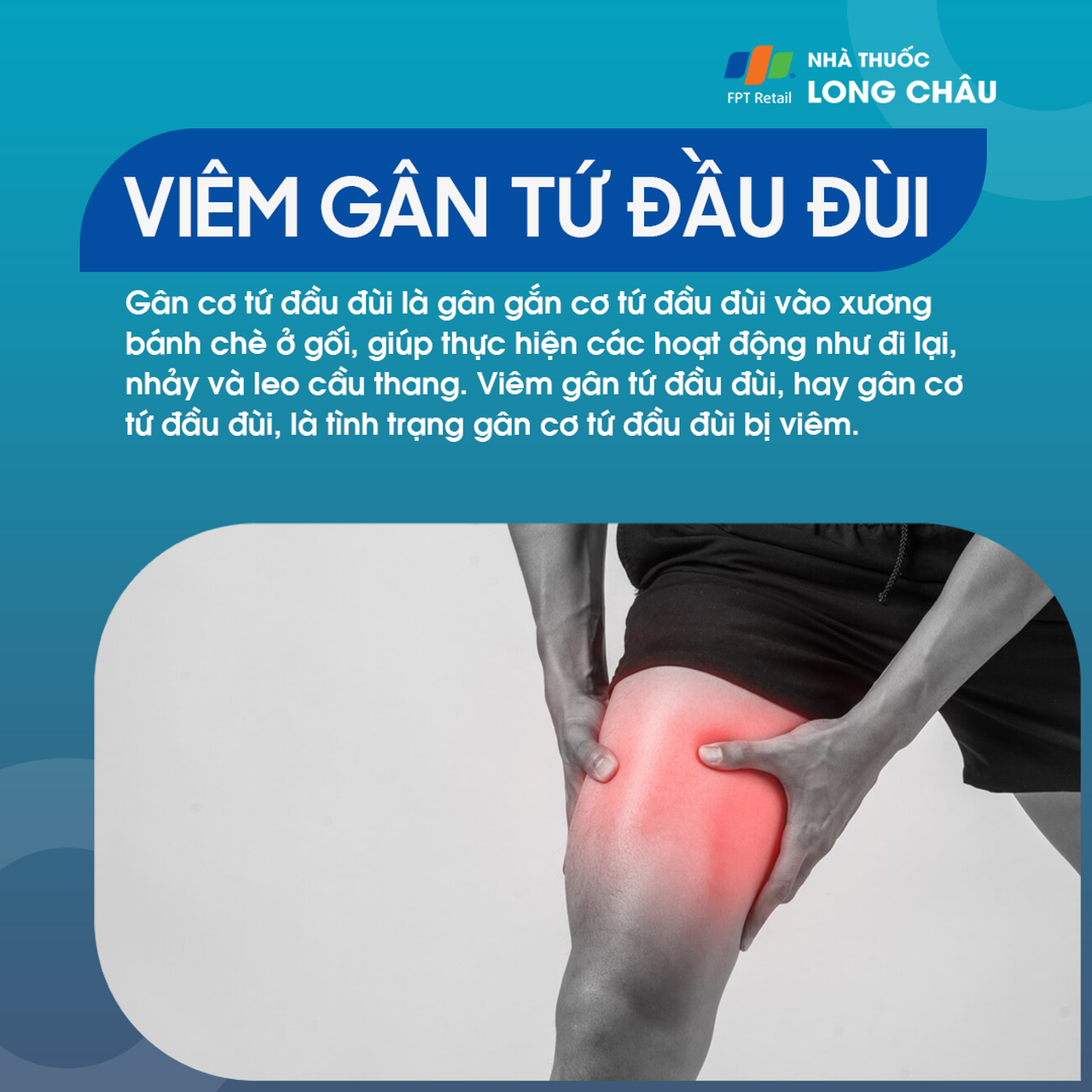 Viêm gân tứ đầu đùi 1