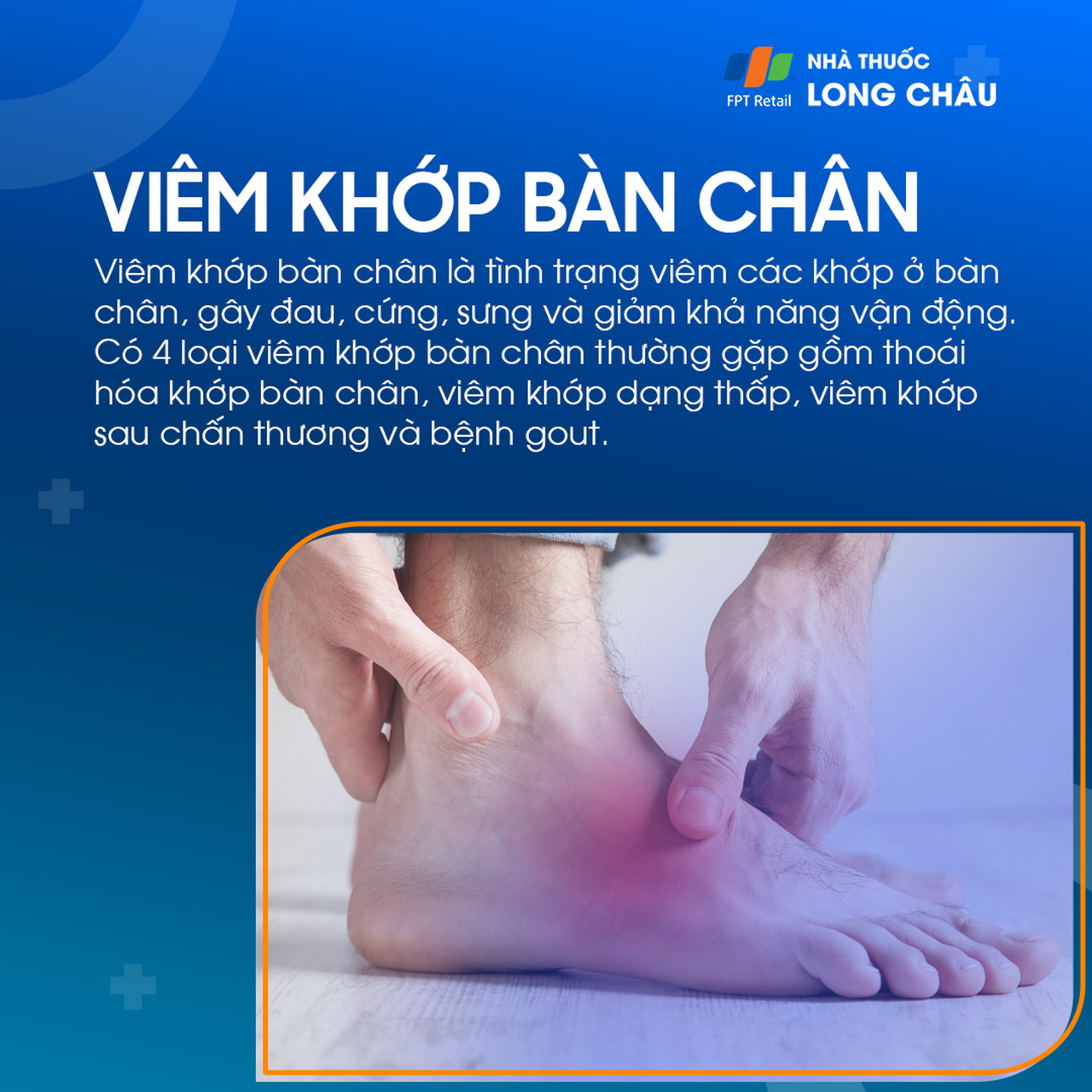 Viêm khớp bàn chân 1