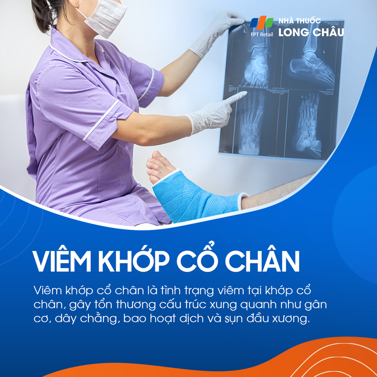 Viêm khớp cổ chân 1