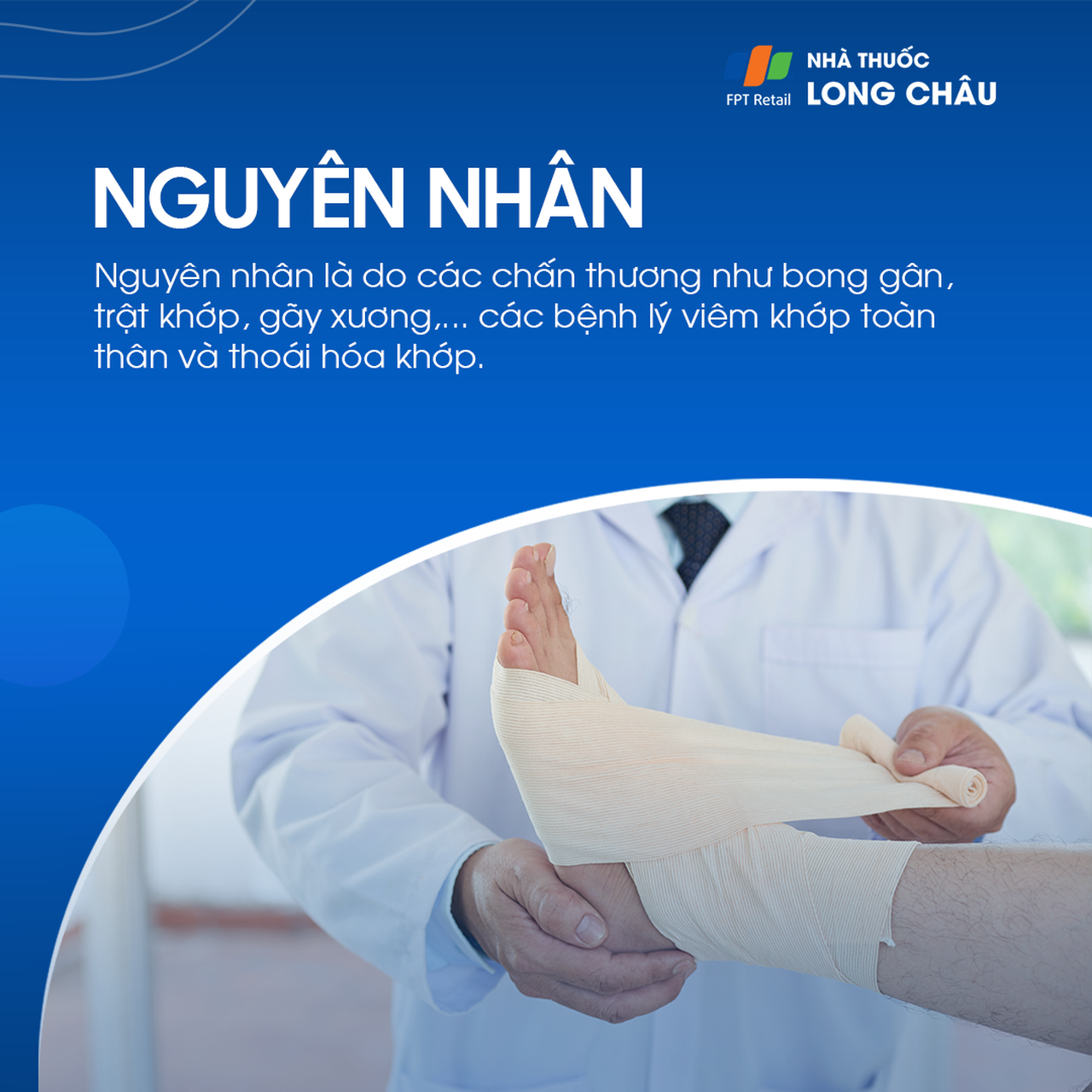 Viêm khớp cổ chân 3