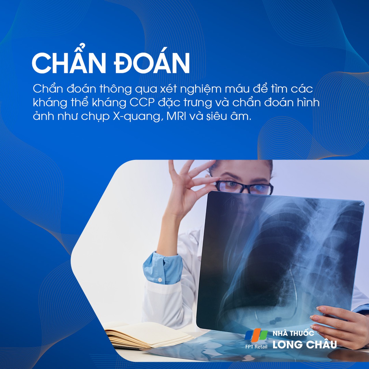 Viêm đa khớp dạng thấp 6