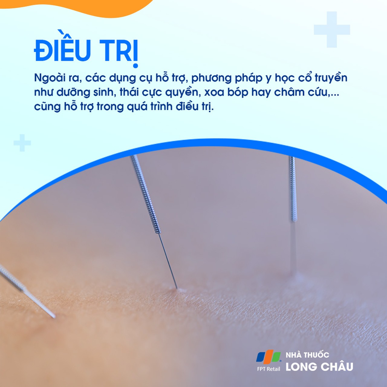 Viêm khớp háng 7