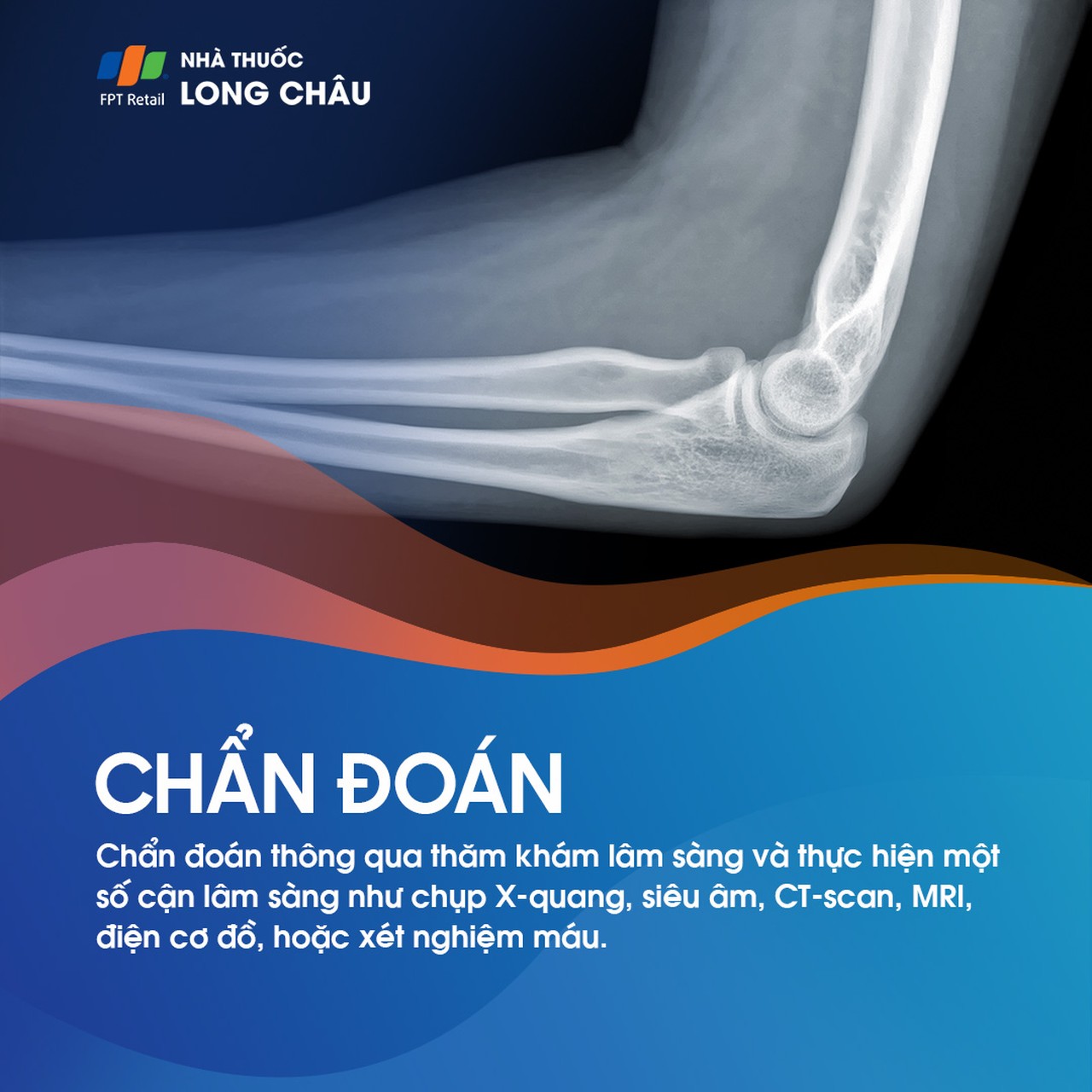 Viêm khớp khuỷu tay 5