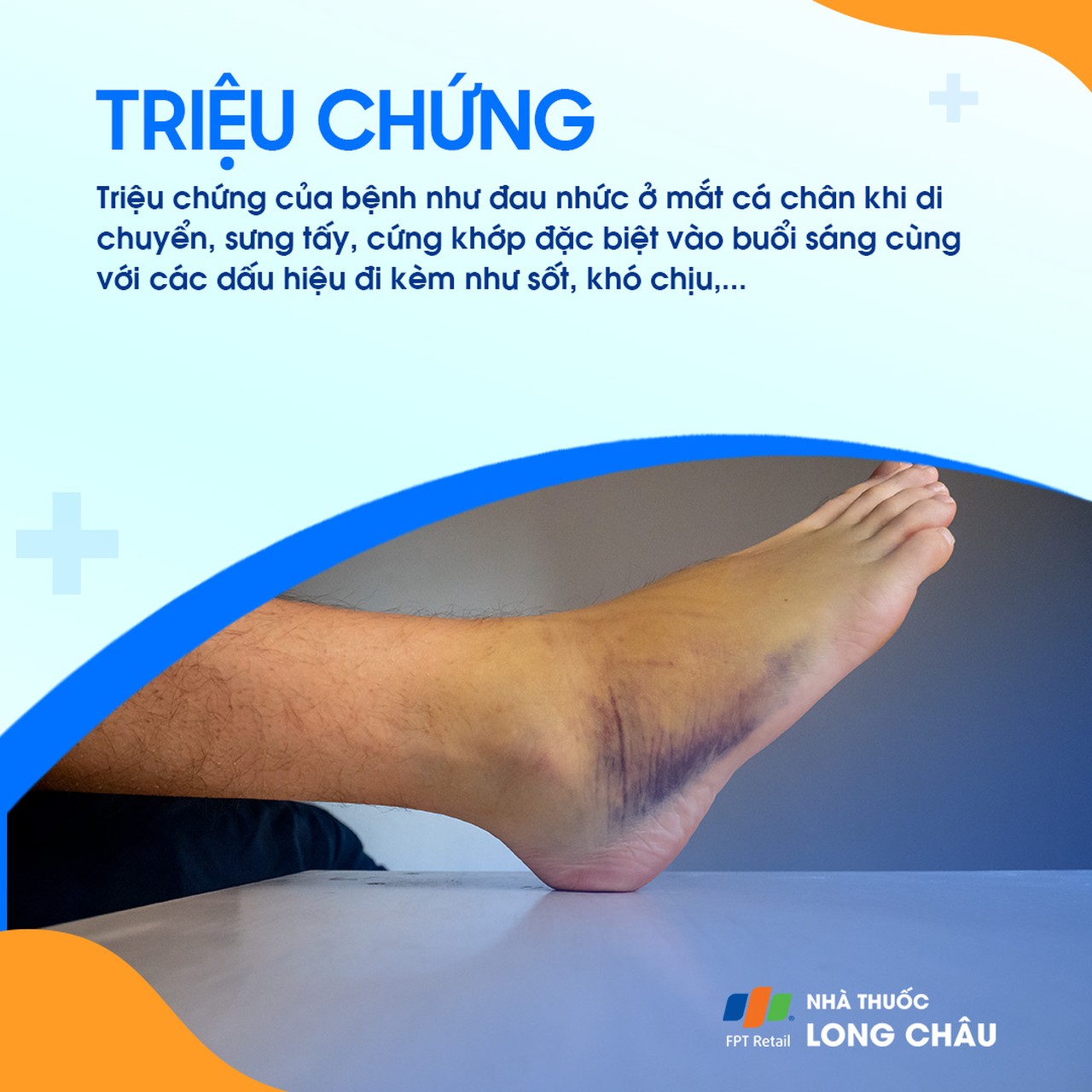 Viêm khớp mắt cá chân 3