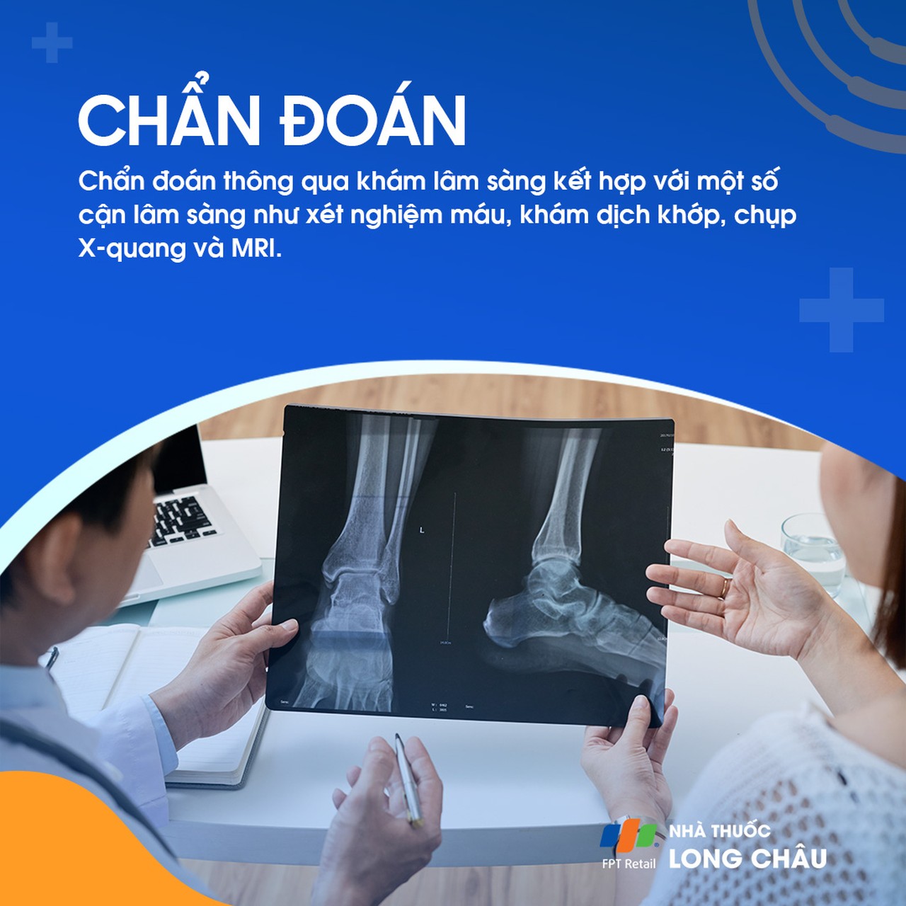 Viêm khớp mắt cá chân 6