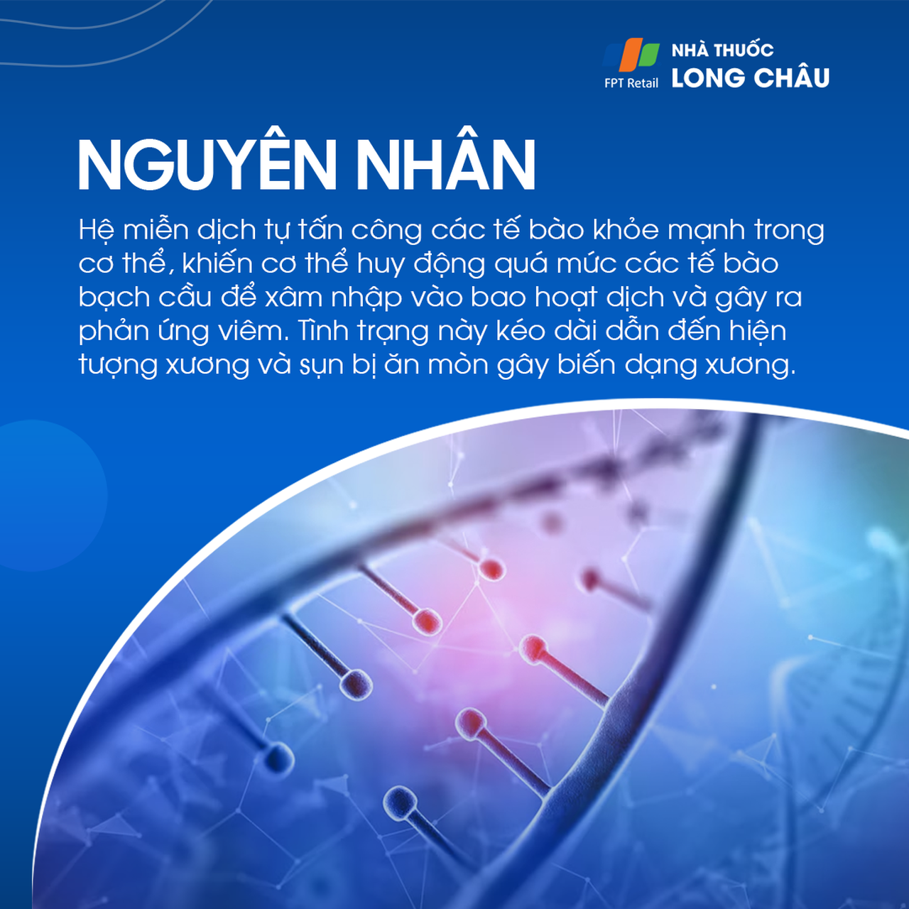 Viêm khớp tự miễn 4