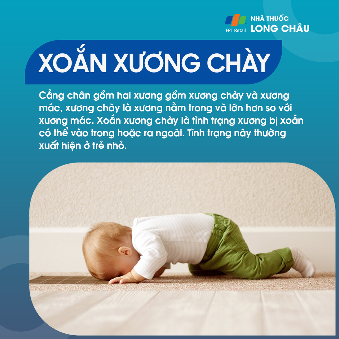 Xoắn xương chày 1