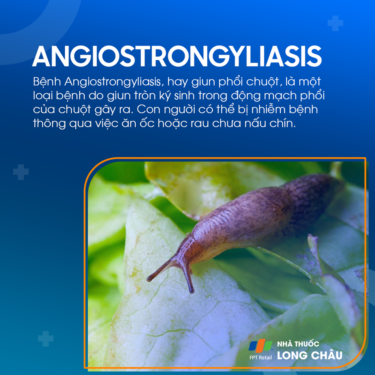Nhiễm bệnh Angiostrongyliasis 1