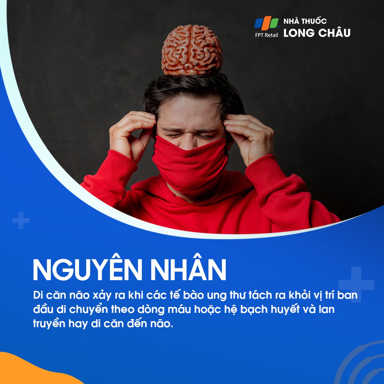 U não thứ phát 3