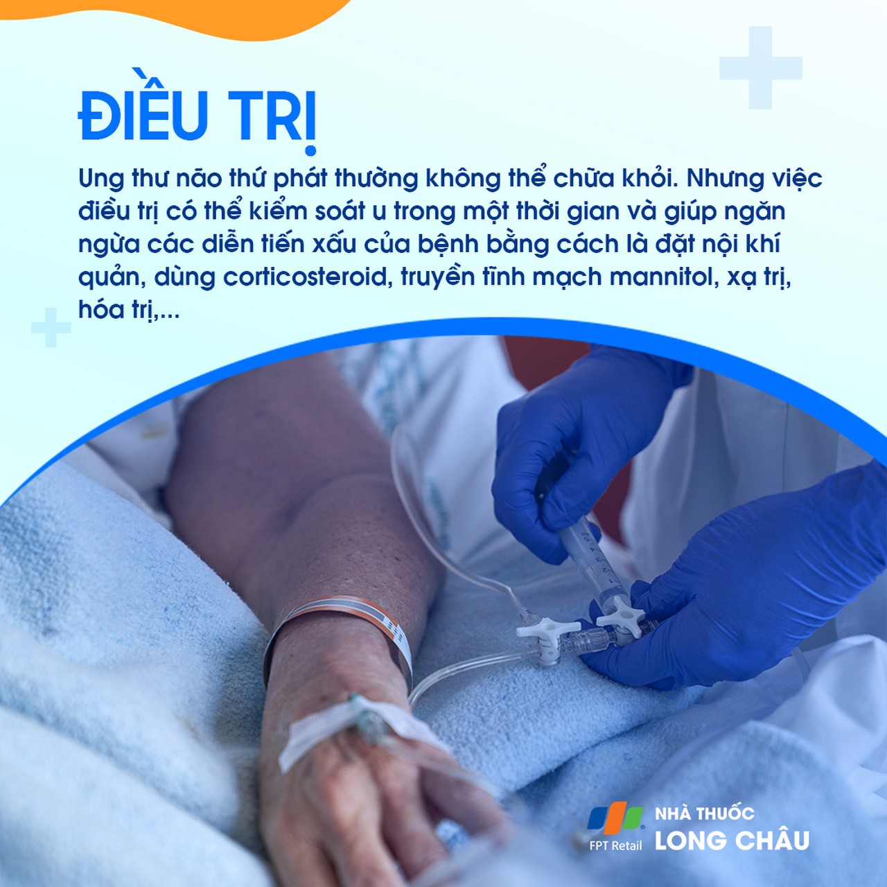 U não thứ phát 7