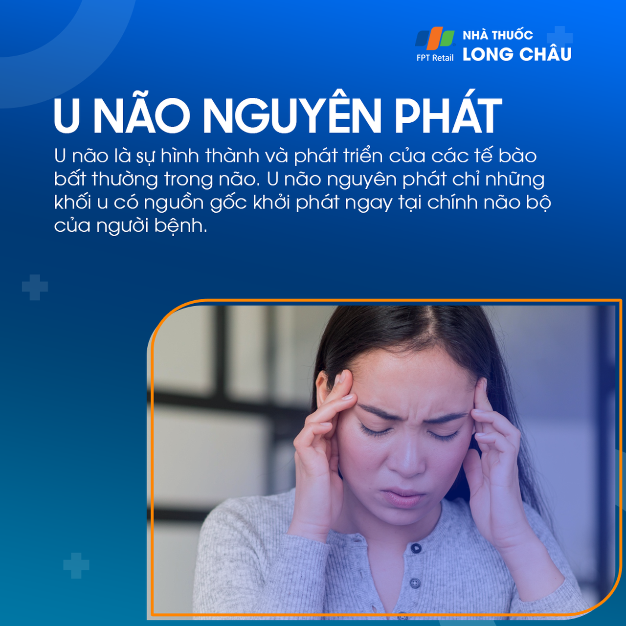 U não nguyên phát 1