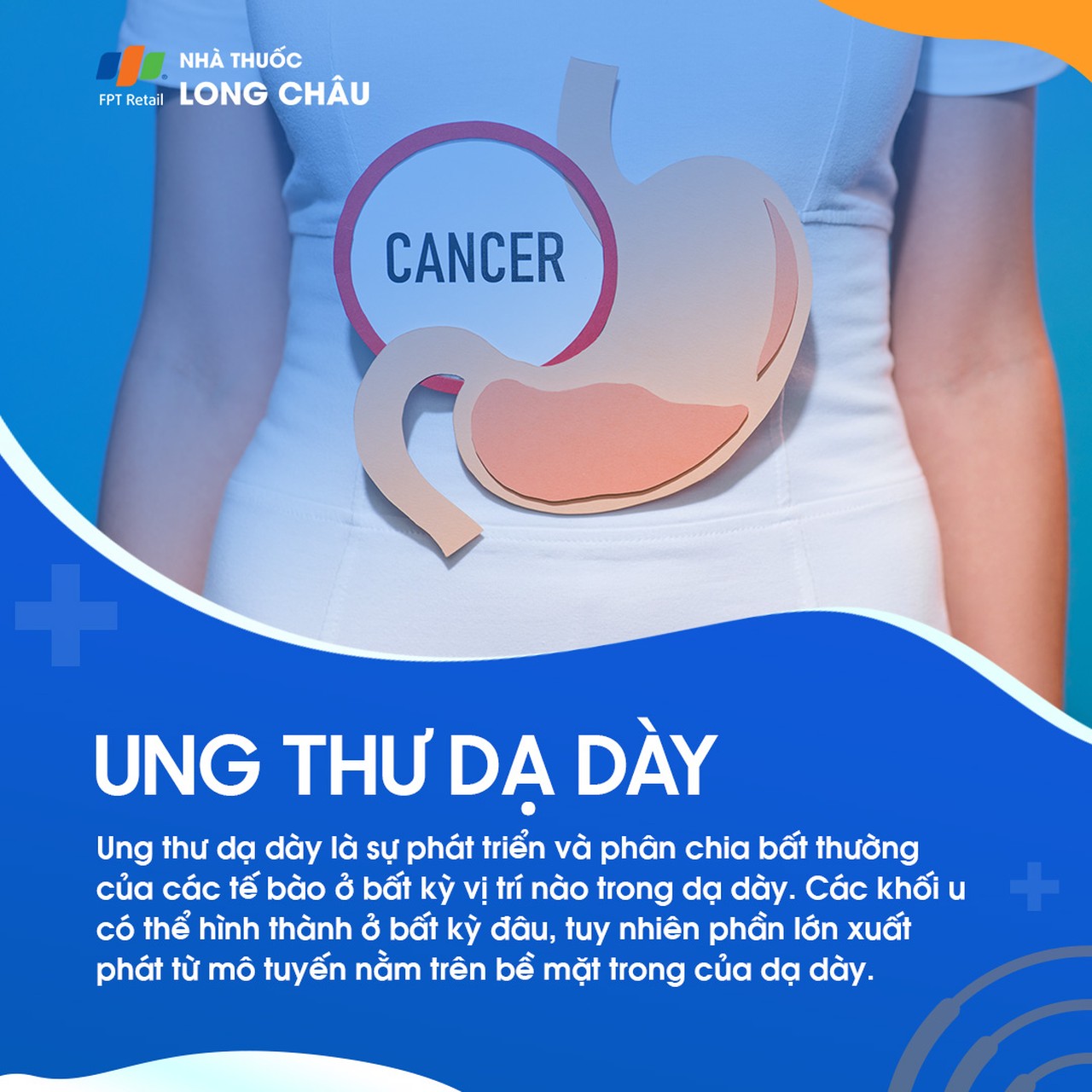 Ung thư dạ dày 1