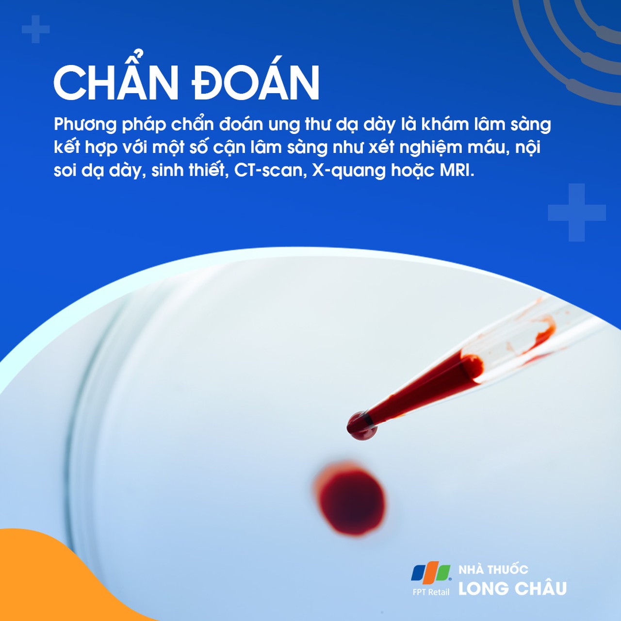 Ung thư dạ dày 5