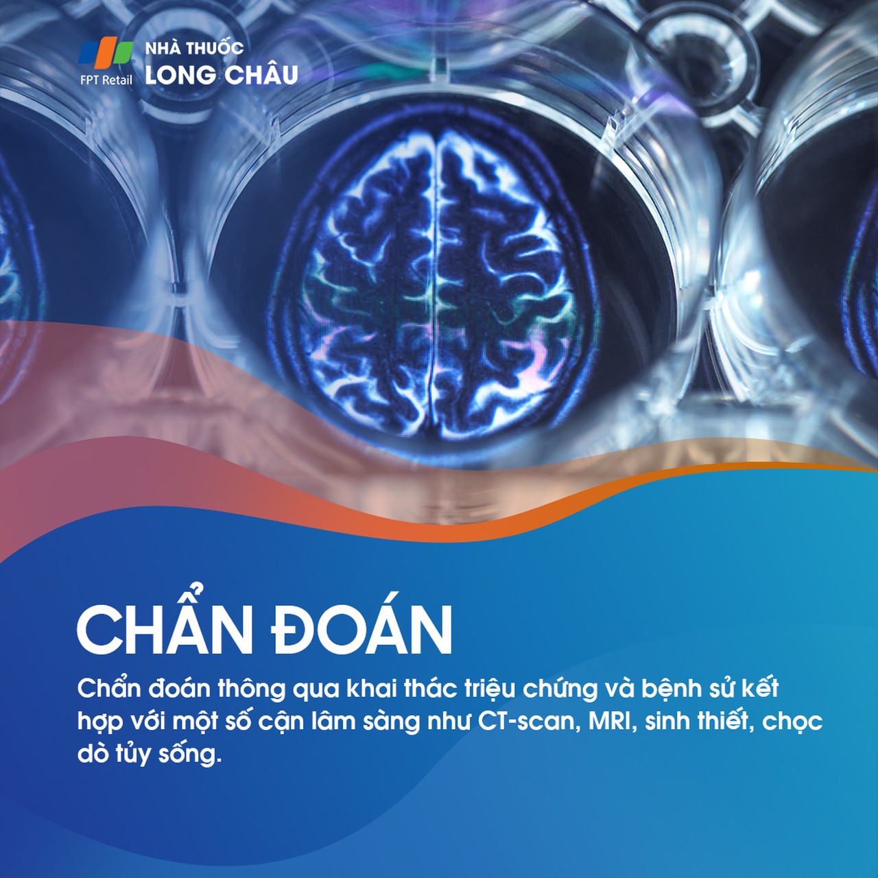 U nguyên tủy bào 5