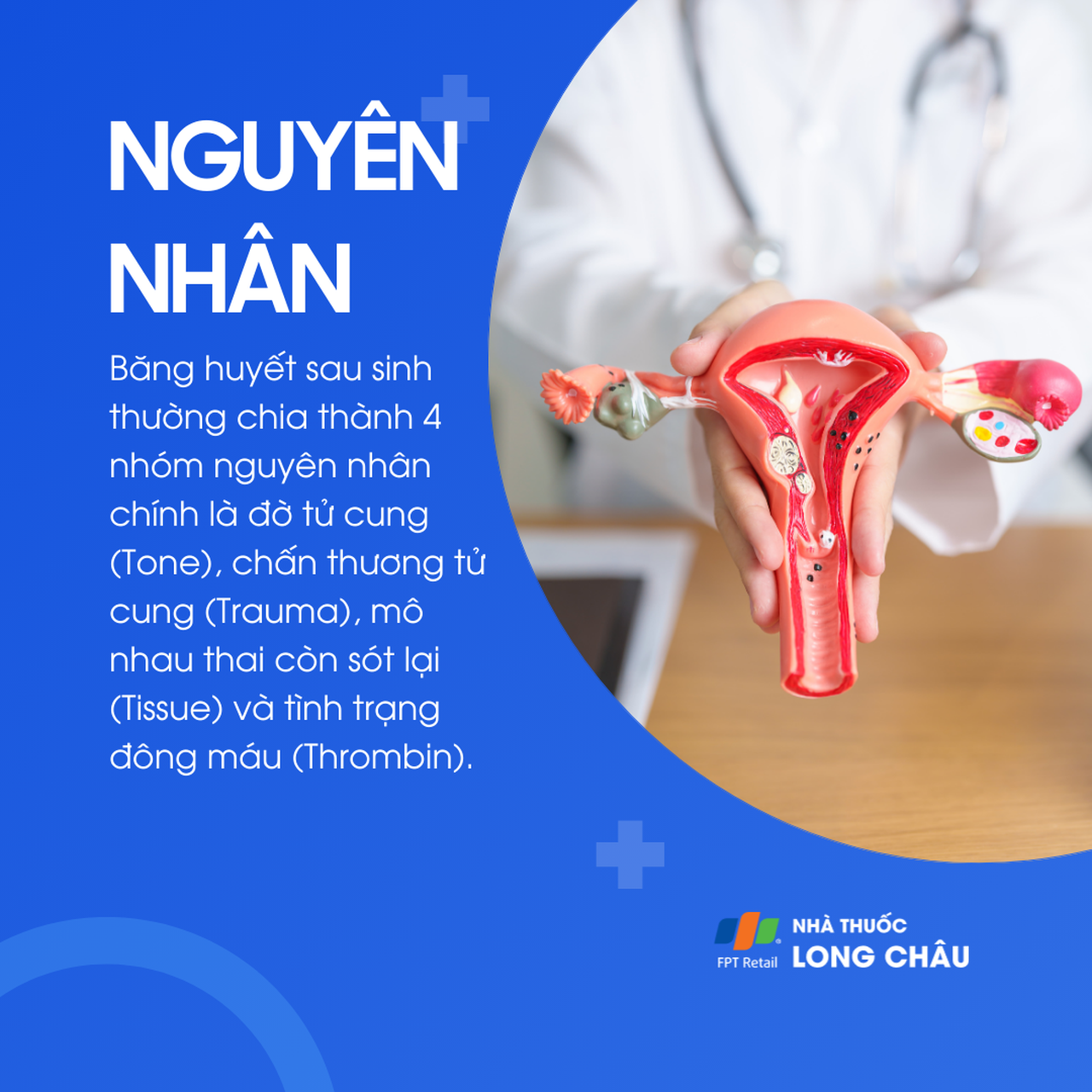 Nguyên nhân băng huyết sau sinh gồm đờ tử cung, chấn thương, sót nhau, rối loạn đông máu
