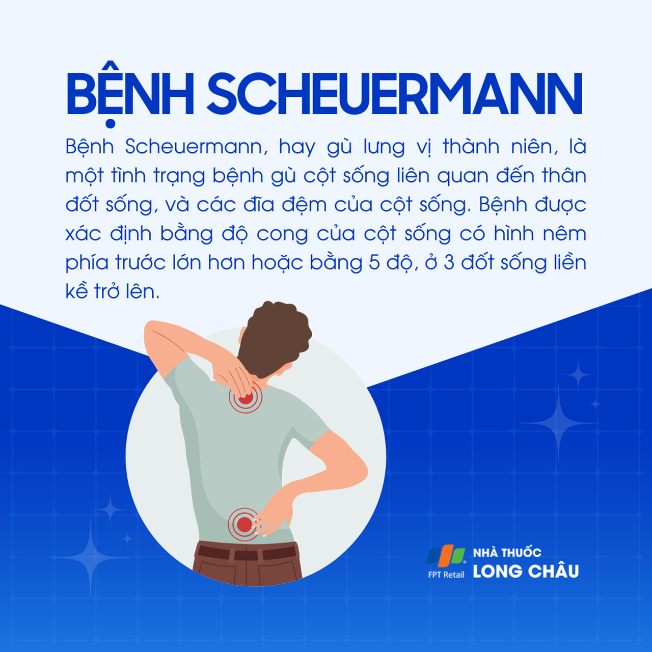 Bệnh Scheuermann 1