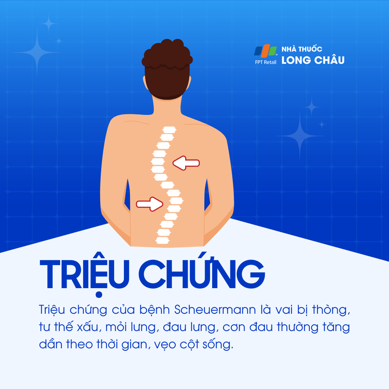 Bệnh Scheuermann 2