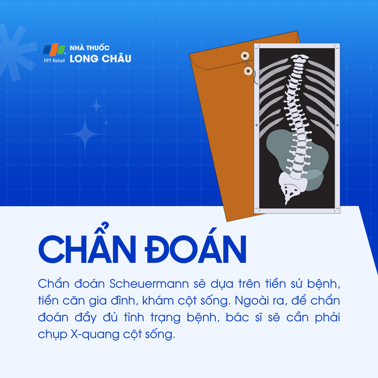 Bệnh Scheuermann 5