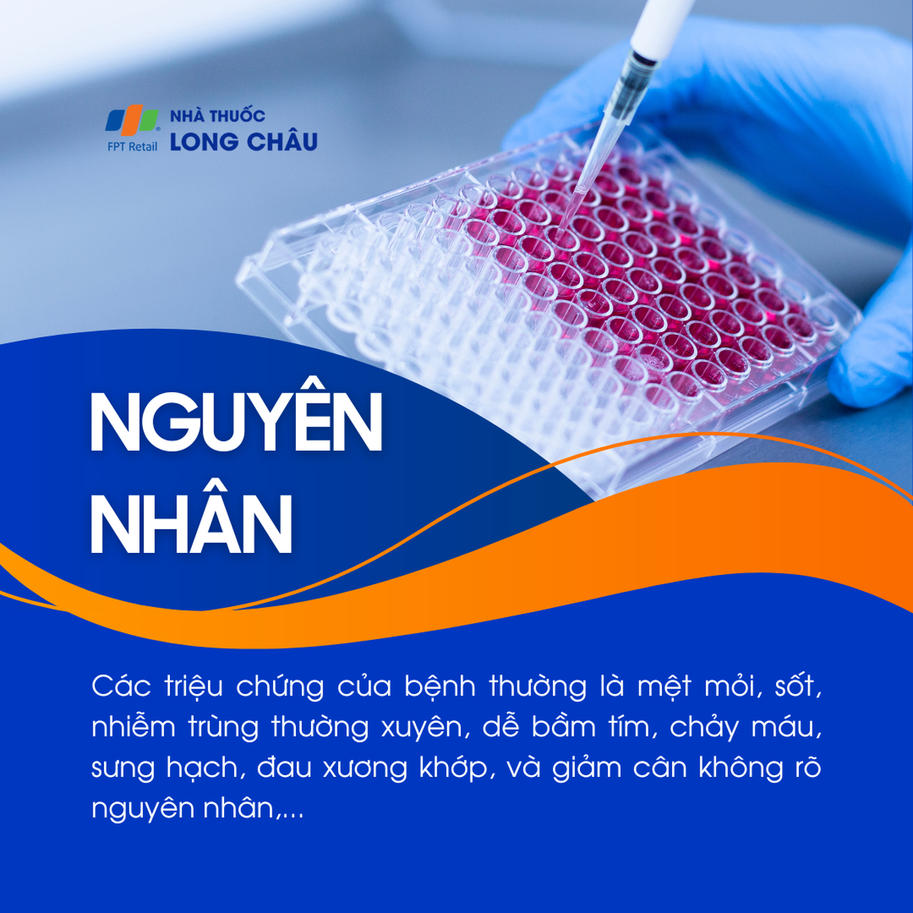 Nguyên nhân bạch cầu chưa rõ ràng, có thể liên quan đến di truyền, đột biến gen trong tủy xương và yếu tố môi trường
