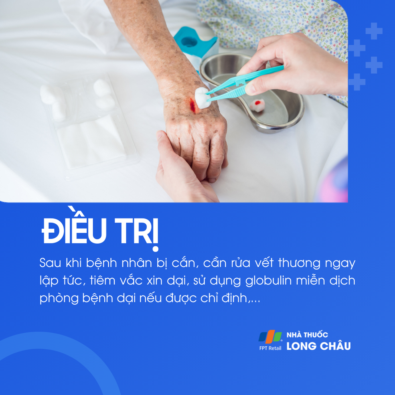 Điều trị bệnh dại gồm rửa vết thương, tiêm vắc xin và globulin miễn dịch