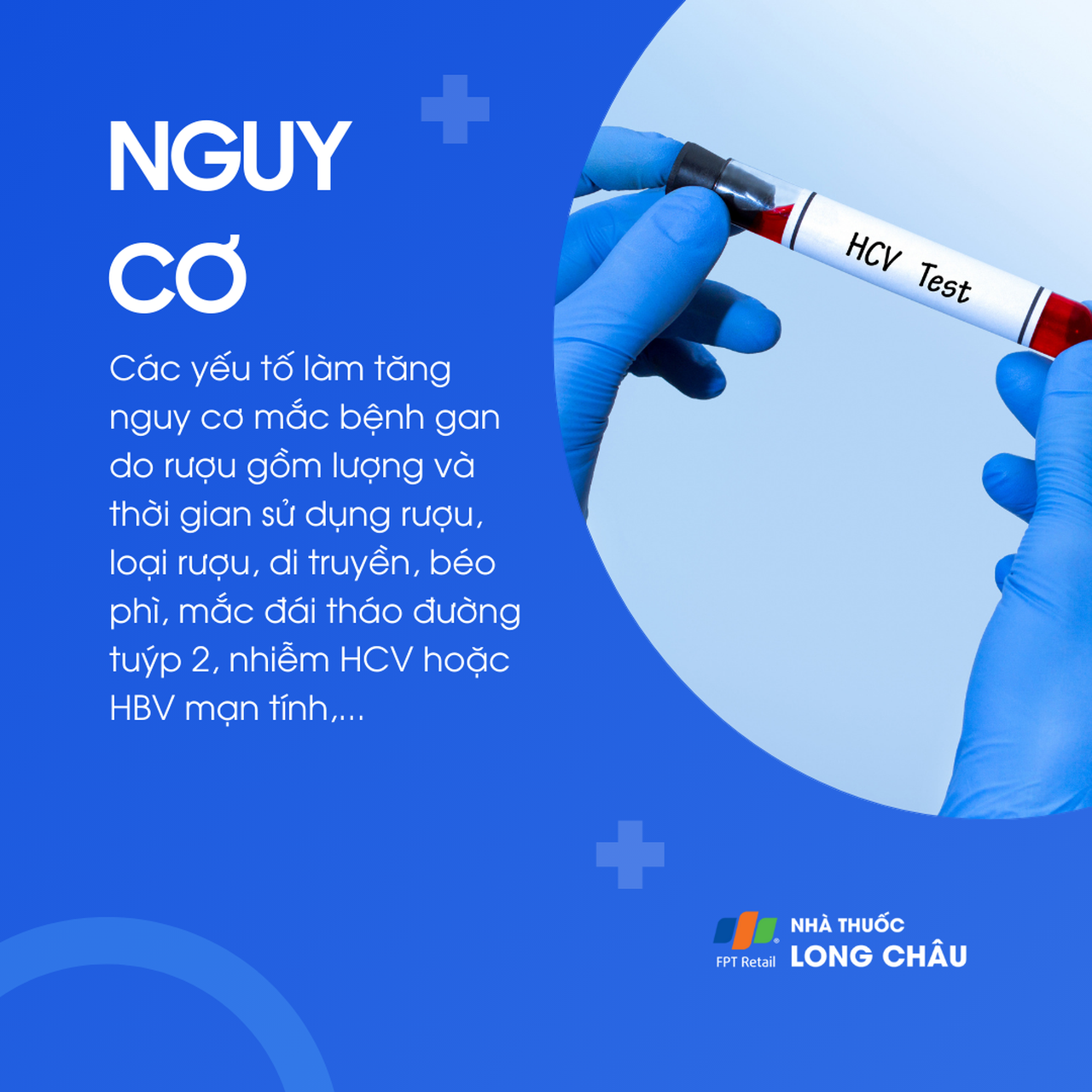 Bệnh gan do rượu 4