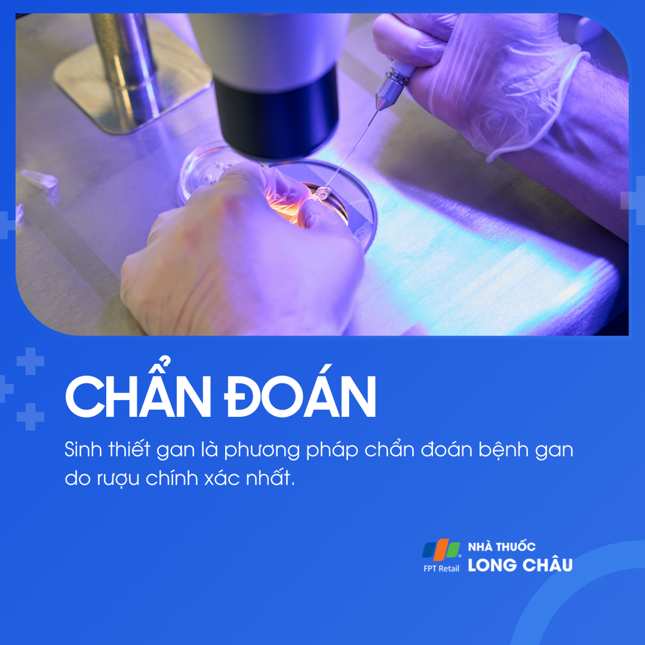Bệnh gan do rượu 5