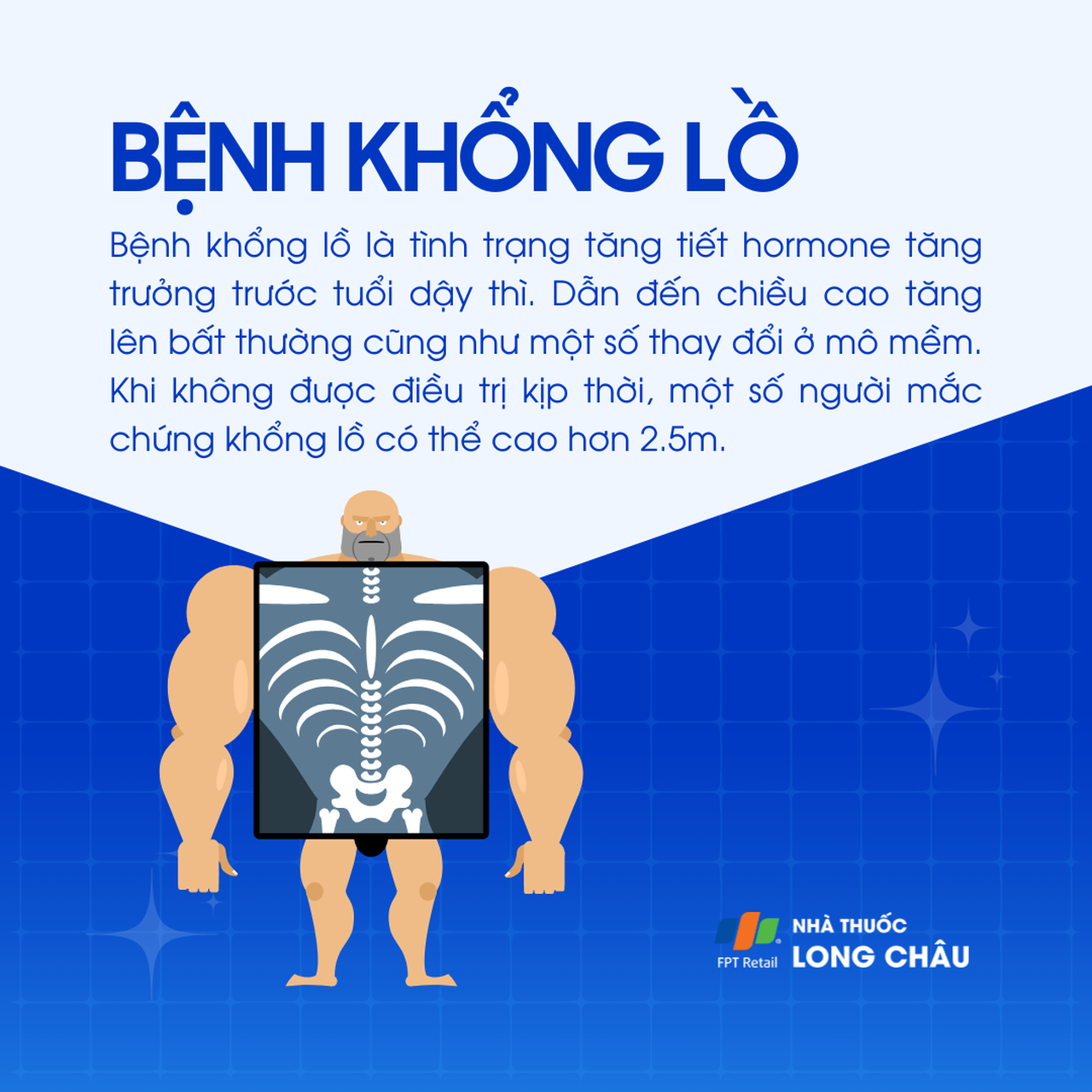 Bệnh khổng lồ 1