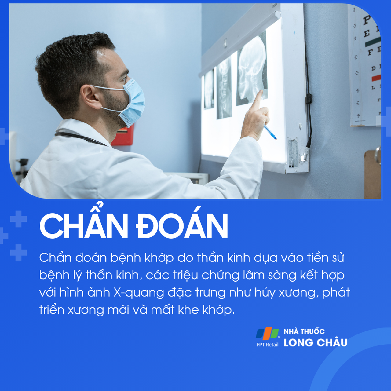 Bệnh khớp do thần kinh 5