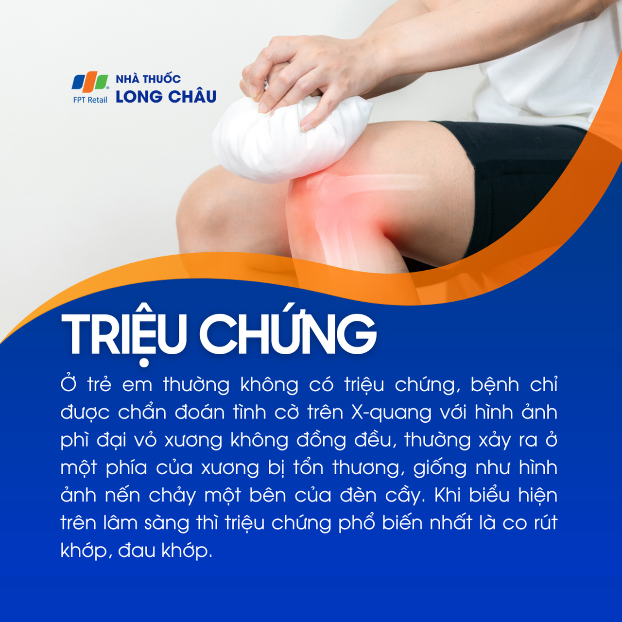 Bệnh nến xương 2