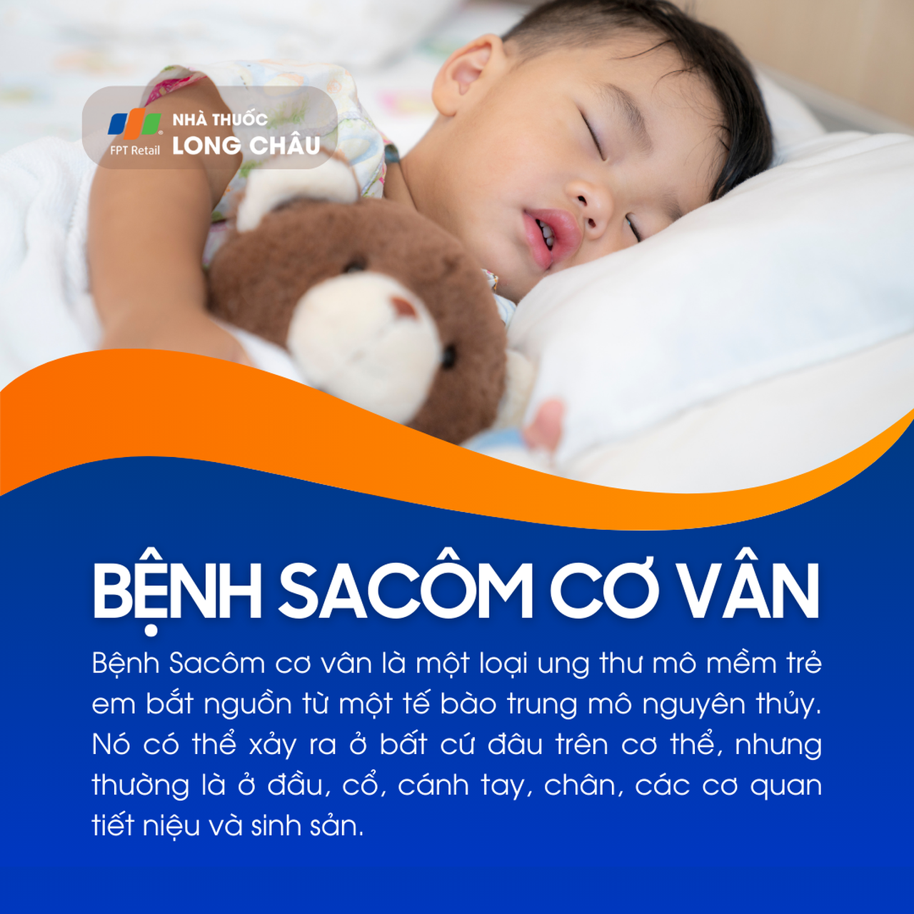 Bệnh Sacôm cơ vân 1