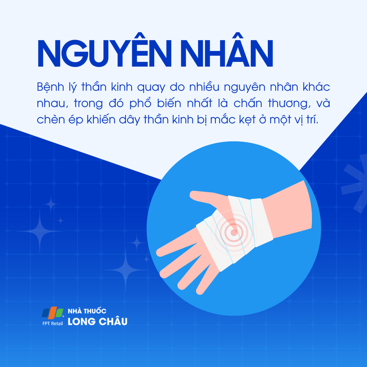 Bệnh thần kinh quay 3