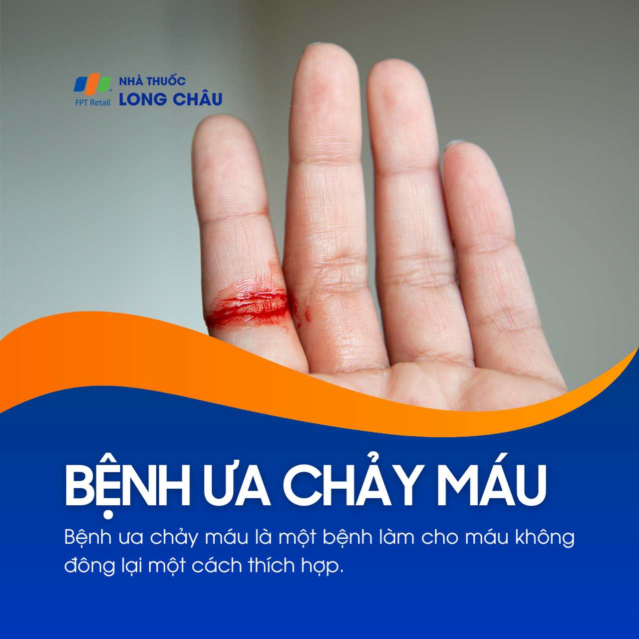 Bệnh ưa chảy máu 1