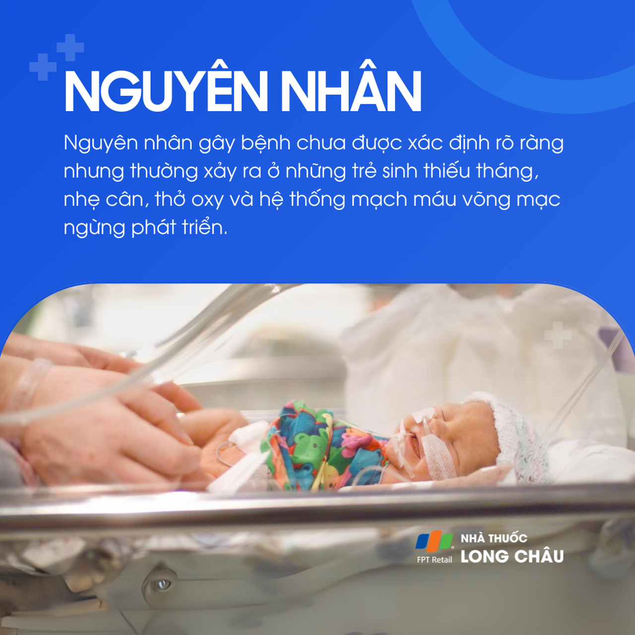 Bong võng mạc trẻ sinh non 4