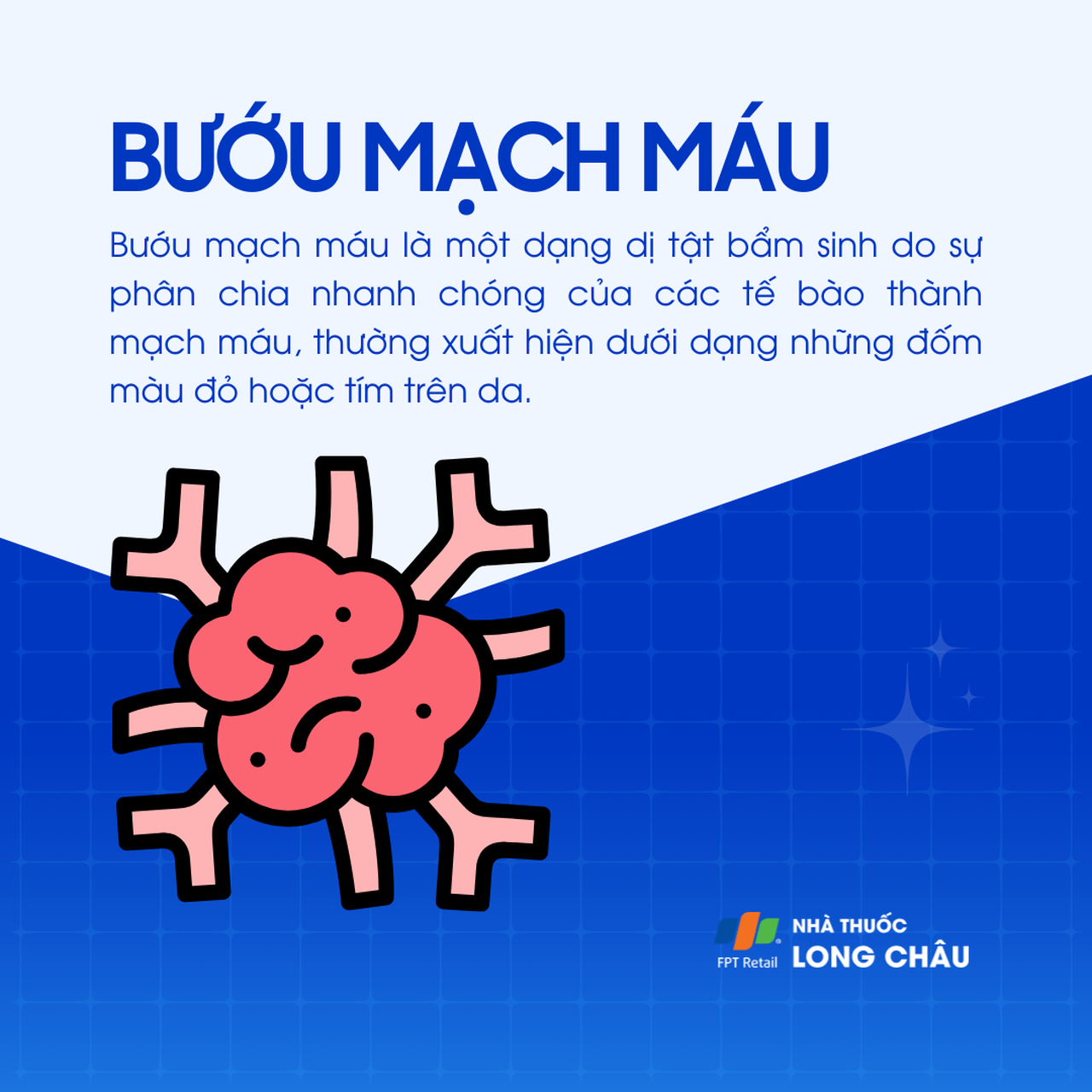 Bướu mạch máu 1