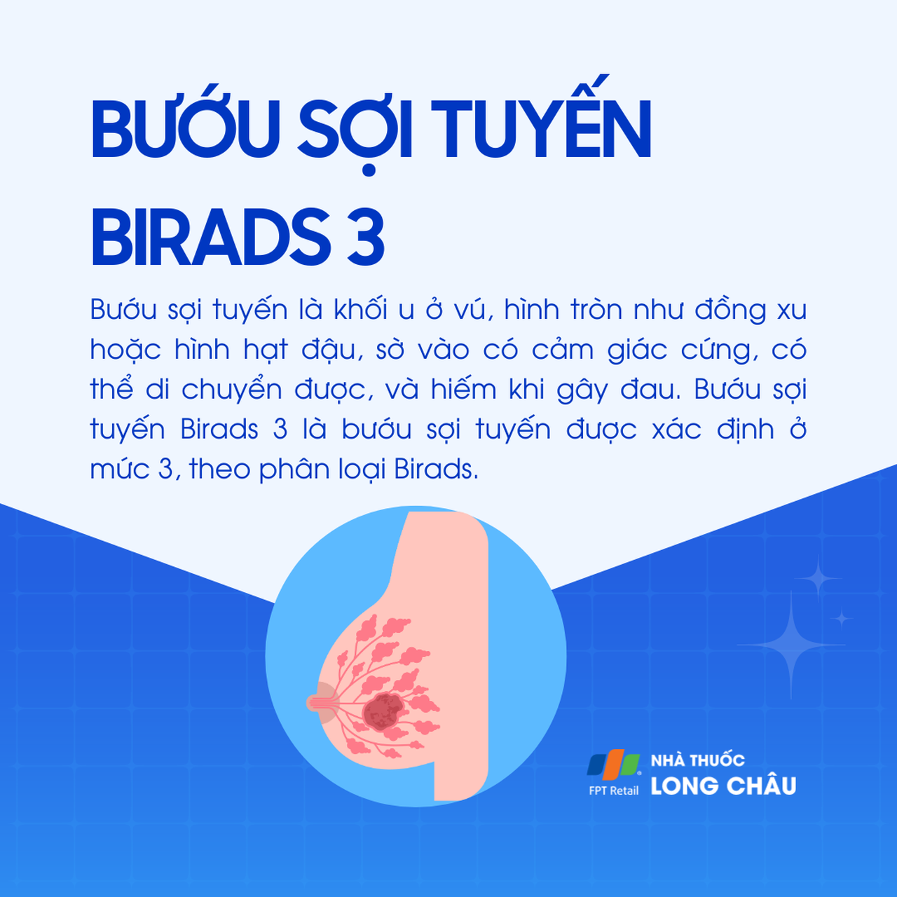 Bướu sợi tuyến vú Birads 3 1