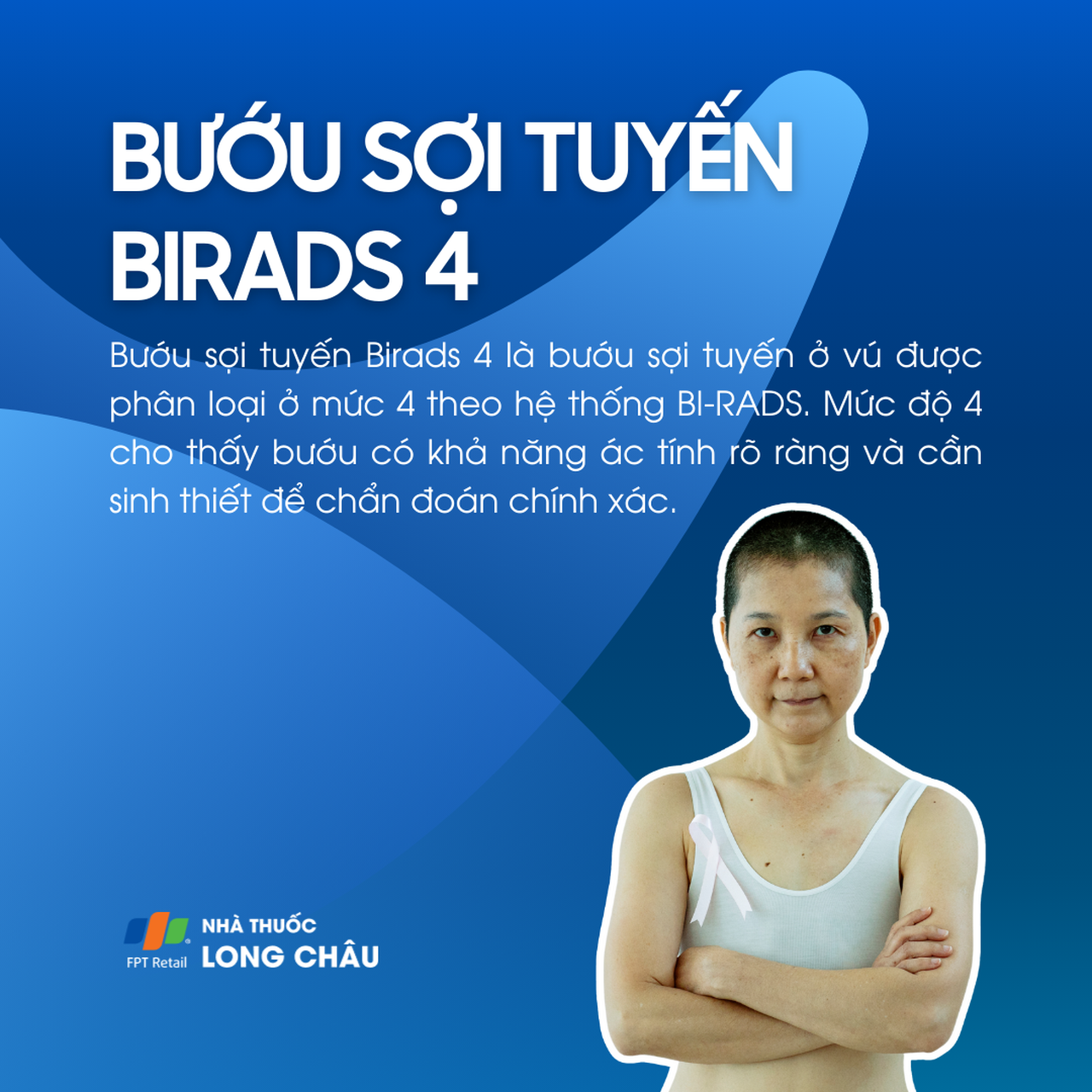 Bướu sợi tuyến Birads 4 là khối u vú có khả năng ác tính cao