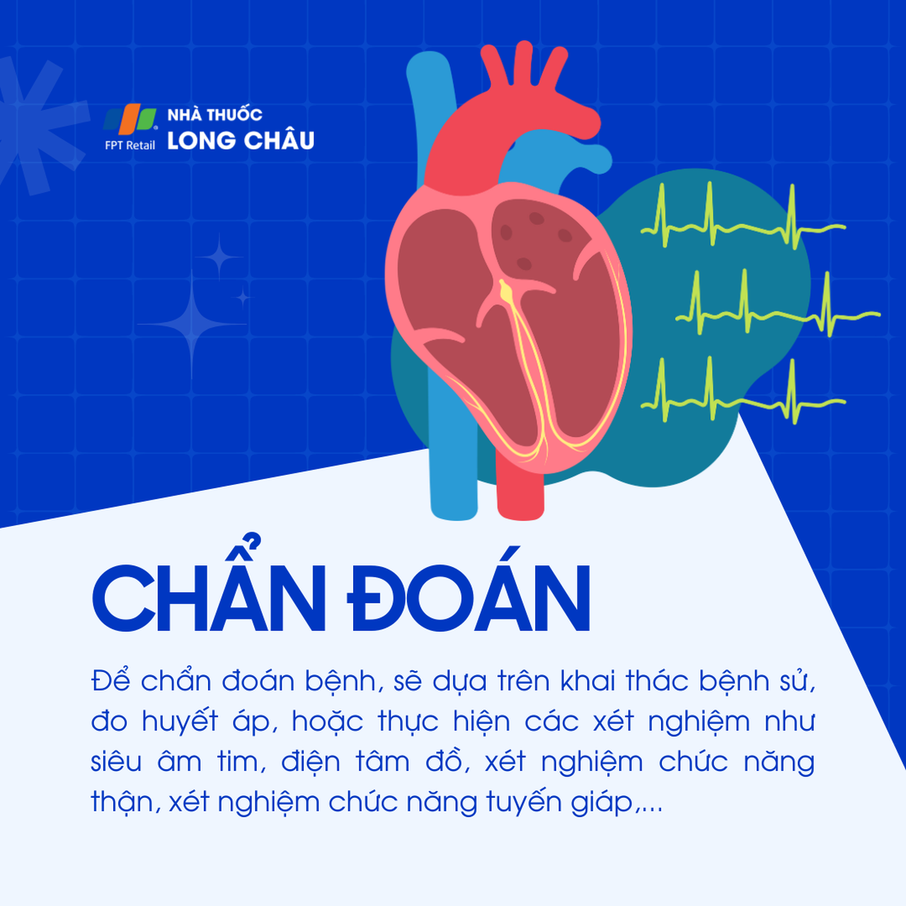 Cao huyết áp vô căn 5