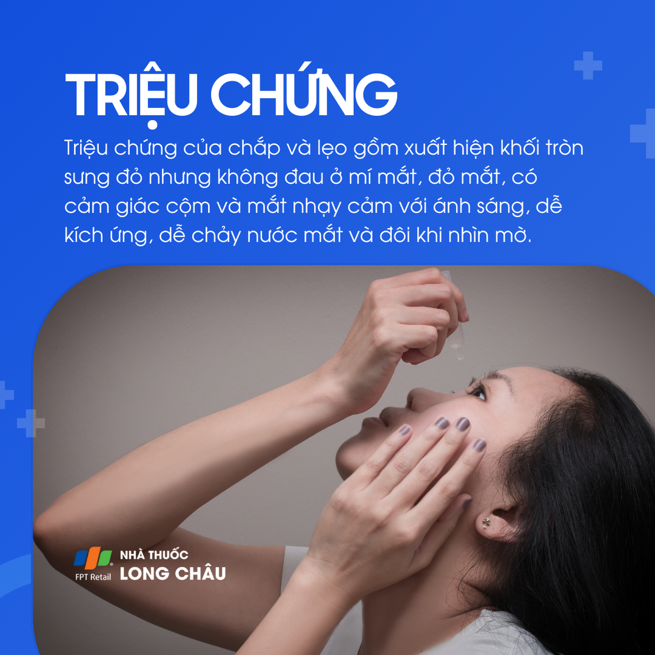 Mí sưng đỏ, cảm giác cộm, chảy nước mắt, nhạy sáng và có thể nhìn mờ là dấu hiệu chắp hoặc lẹo