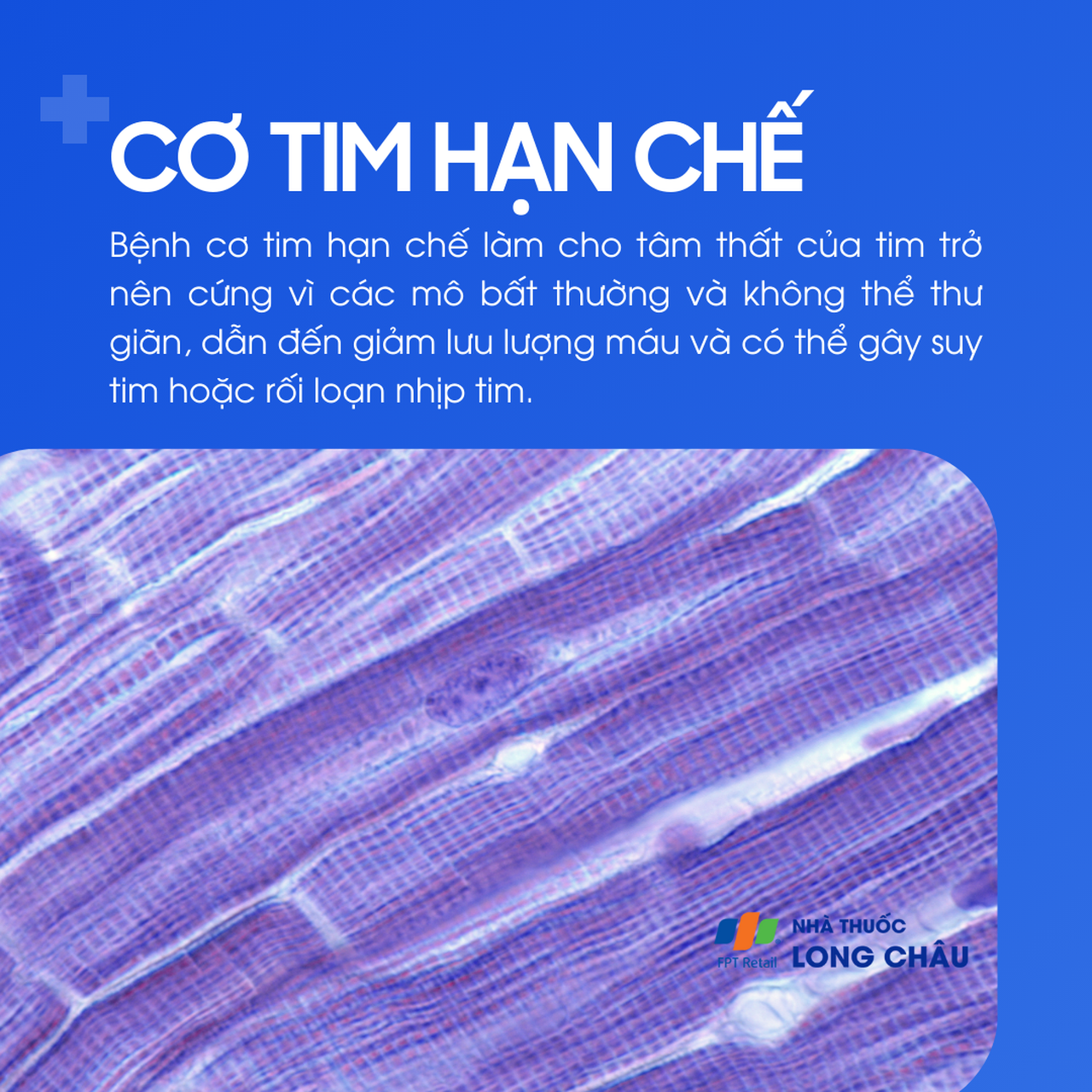 Cơ tim hạn chế 1