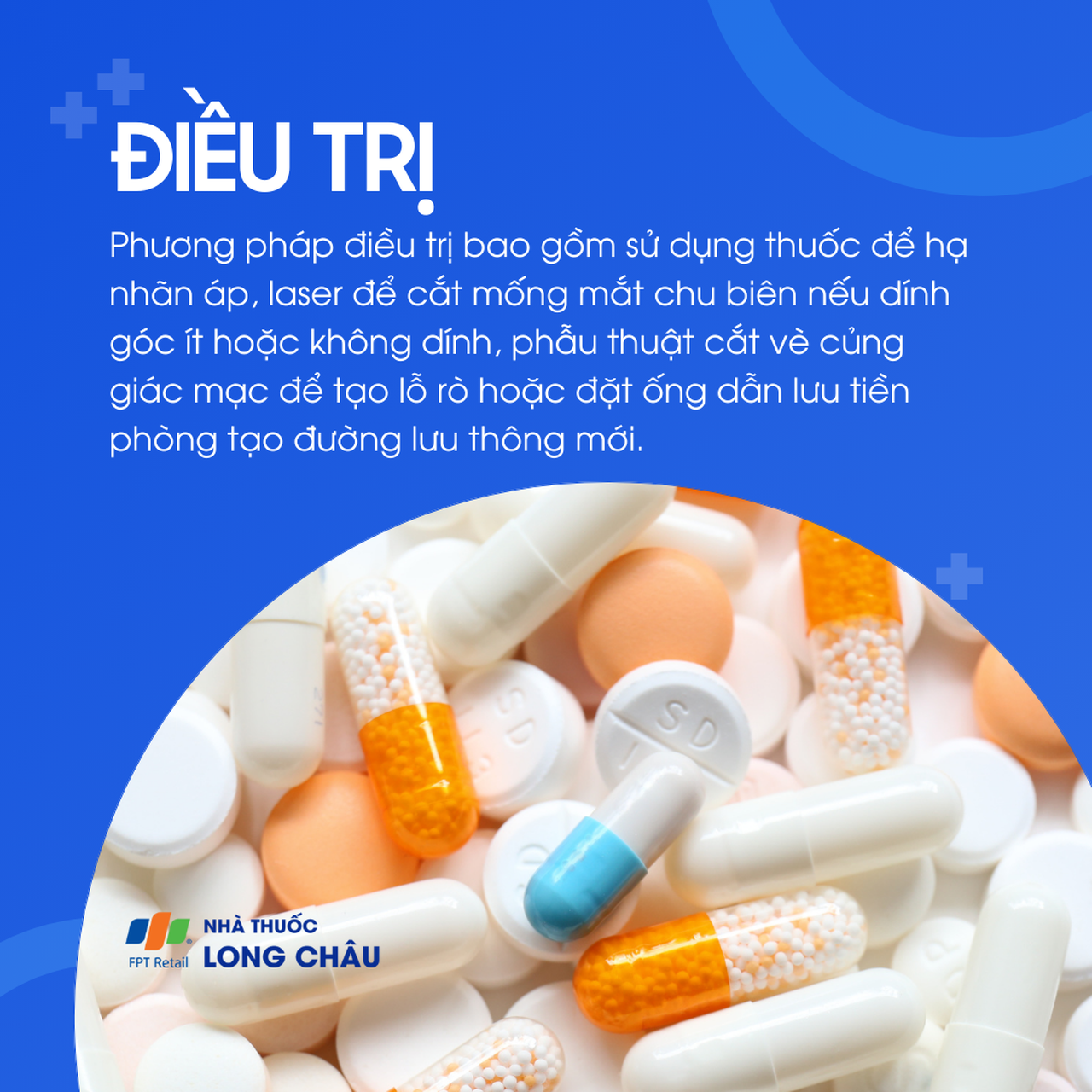 Điều trị cườm nước gồm dùng thuốc hạ nhãn áp, laser cắt mống mắt, hoặc phẫu thuật tạo đường dẫn lưu