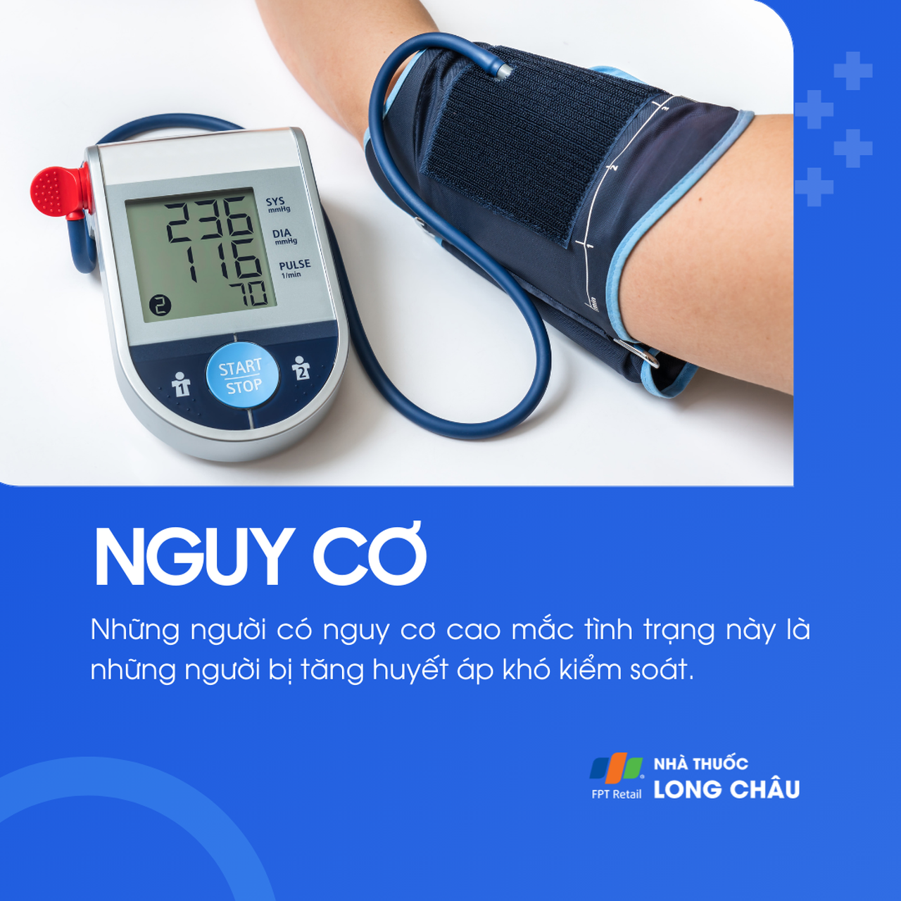  Cường aldosteron 4