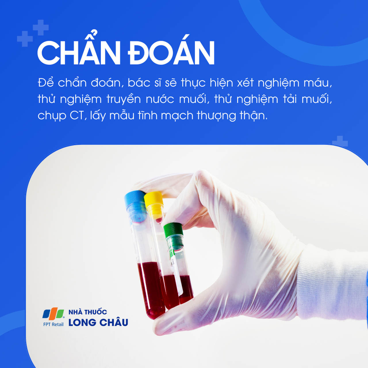  Cường aldosteron 5