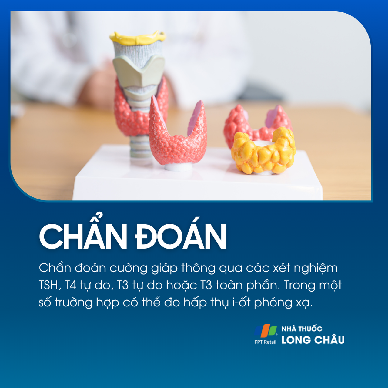 Chẩn đoán dựa trên xét nghiệm TSH, T3, T4, hoặc hấp thu iod phóng xạ