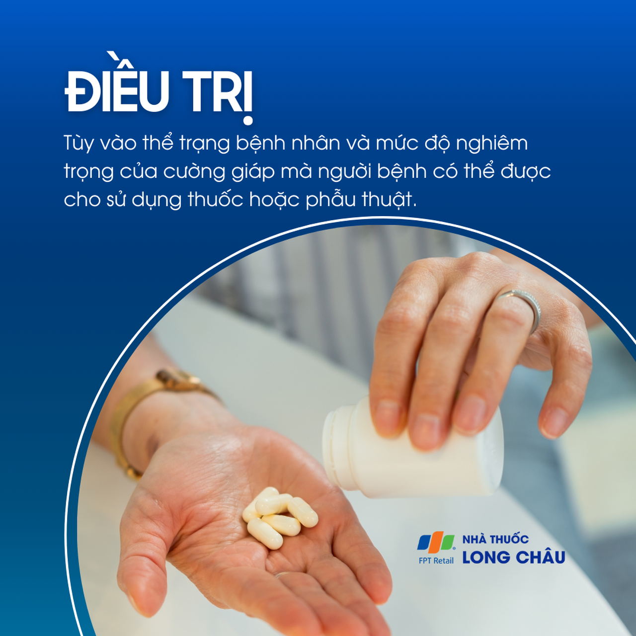 Tuỳ mức độ, bệnh nhân có thể được chỉ định dùng thuốc hoặc phẫu thuật tuyến giáp