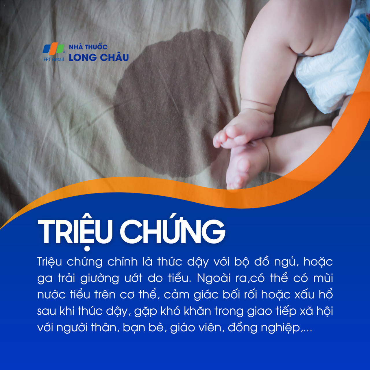 Trẻ thường thức dậy với quần áo hoặc giường ướt, có thể kèm cảm giác xấu hổ hoặc khó giao tiếp