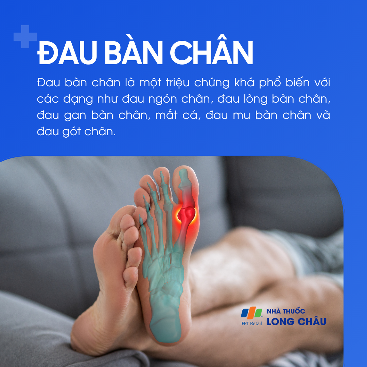 Đau bàn chân 1